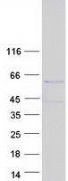 C17orf85 Protein - Purified recombinant protein C17orf85 was analyzed by SDS-PAGE gel and Coomassie Blue Staining