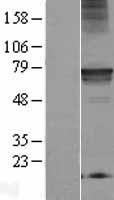 C18orf8 / MIC1; Protein - Western validation with an anti-DDK antibody * L: Control HEK293 lysate R: Over-expression lysate