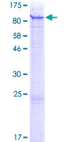 C18orf8 / MIC1; Protein - 12.5% SDS-PAGE of human C18orf8 stained with Coomassie Blue