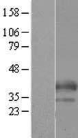 C19orf18 Protein - Western validation with an anti-DDK antibody * L: Control HEK293 lysate R: Over-expression lysate