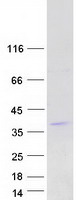 C19orf22 Protein - Purified recombinant protein R3HDM4 was analyzed by SDS-PAGE gel and Coomassie Blue Staining