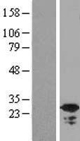 C19orf39 Protein - Western validation with an anti-DDK antibody * L: Control HEK293 lysate R: Over-expression lysate