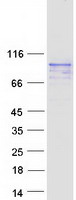 C19orf44 Protein - Purified recombinant protein C19orf44 was analyzed by SDS-PAGE gel and Coomassie Blue Staining