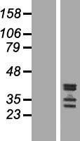 C19orf47 Protein - Western validation with an anti-DDK antibody * L: Control HEK293 lysate R: Over-expression lysate