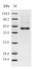 C19orf48 Protein - (Tris-Glycine gel) Discontinuous SDS-PAGE (reduced) with 5% enrichment gel and 15% separation gel.