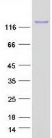 C19orf57 Protein - Purified recombinant protein C19orf57 was analyzed by SDS-PAGE gel and Coomassie Blue Staining
