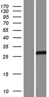 C19orf81 Protein - Western validation with an anti-DDK antibody * L: Control HEK293 lysate R: Over-expression lysate