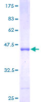 C1D Protein - 12.5% SDS-PAGE of human C1D stained with Coomassie Blue