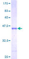 C1D Protein - 12.5% SDS-PAGE of human C1D stained with Coomassie Blue