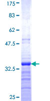 C1D Protein - 12.5% SDS-PAGE Stained with Coomassie Blue.