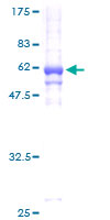 C1GALT1C1 Protein - 12.5% SDS-PAGE of human C1GALT1C1 stained with Coomassie Blue
