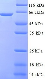 C1orf106 Protein