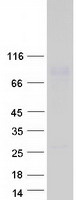 C1orf106 Protein - Purified recombinant protein C1orf106 was analyzed by SDS-PAGE gel and Coomassie Blue Staining
