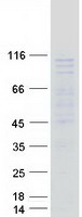 C1orf107 / DEF Protein - Purified recombinant protein DIEXF was analyzed by SDS-PAGE gel and Coomassie Blue Staining