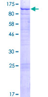 C1orf112 Protein - 12.5% SDS-PAGE of human C1orf112 stained with Coomassie Blue