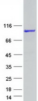 C1orf116 Protein - Purified recombinant protein C1orf116 was analyzed by SDS-PAGE gel and Coomassie Blue Staining