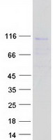 C1orf127 Protein - Purified recombinant protein C1orf127 was analyzed by SDS-PAGE gel and Coomassie Blue Staining