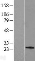 C1orf158 Protein - Western validation with an anti-DDK antibody * L: Control HEK293 lysate R: Over-expression lysate