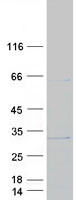 C1orf158 Protein - Purified recombinant protein C1orf158 was analyzed by SDS-PAGE gel and Coomassie Blue Staining