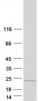 C1orf194 Protein - Purified recombinant protein C1orf194 was analyzed by SDS-PAGE gel and Coomassie Blue Staining