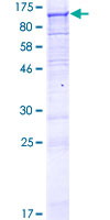 C1orf2 / FAM189B Protein - 12.5% SDS-PAGE of human C1orf2 stained with Coomassie Blue