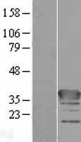 C1orf222 Protein - Western validation with an anti-DDK antibody * L: Control HEK293 lysate R: Over-expression lysate