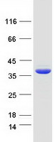 C1orf222 Protein - Purified recombinant protein C1orf222 was analyzed by SDS-PAGE gel and Coomassie Blue Staining