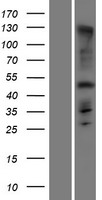 C1orf228 Protein - Western validation with an anti-DDK antibody * L: Control HEK293 lysate R: Over-expression lysate