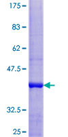 C1orf31 Protein - 12.5% SDS-PAGE of human C1orf31 stained with Coomassie Blue