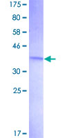 C1orf38 Protein - 12.5% SDS-PAGE of human C1orf38 stained with Coomassie Blue