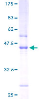 C1orf54 Protein - 12.5% SDS-PAGE of human FLJ23221 stained with Coomassie Blue