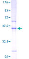 C1orf54 Protein - 12.5% SDS-PAGE of human FLJ23221 stained with Coomassie Blue