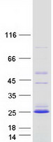 C1orf86 Protein - Purified recombinant protein FAAP20 was analyzed by SDS-PAGE gel and Coomassie Blue Staining