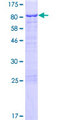 C1orf87 Protein - 12.5% SDS-PAGE of human C1orf87 stained with Coomassie Blue