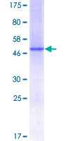 C1QG / Complement C1QC Protein - 12.5% SDS-PAGE of human C1QC stained with Coomassie Blue