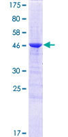 C1QL1 Protein - 12.5% SDS-PAGE of human C1QL1 stained with Coomassie Blue