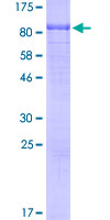 C1qRP / CD93 Protein - 12.5% SDS-PAGE Stained with Coomassie Blue.