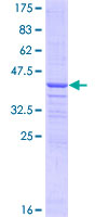 C1qRP / CD93 Protein - 12.5% SDS-PAGE Stained with Coomassie Blue.