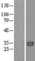 C1QTNF1 / CTRP1 Protein - Western validation with an anti-DDK antibody * L: Control HEK293 lysate R: Over-expression lysate