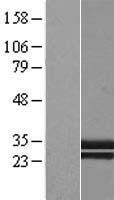 C1QTNF1 / CTRP1 Protein - Western validation with an anti-DDK antibody * L: Control HEK293 lysate R: Over-expression lysate