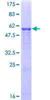C1QTNF1 / CTRP1 Protein - 12.5% SDS-PAGE of human C1QTNF1 stained with Coomassie Blue