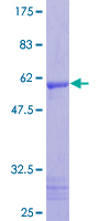 C1QTNF2 / CTRP2 Protein - 12.5% SDS-PAGE of human C1QTNF2 stained with Coomassie Blue