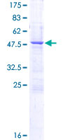 C1QTNF3 / CTRP3 Protein - 12.5% SDS-PAGE of human C1QTNF3 stained with Coomassie Blue