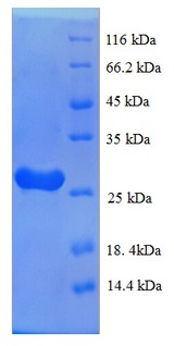 C1QTNF3 / CTRP3 Protein