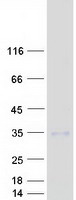 C1QTNF3 / CTRP3 Protein - Purified recombinant protein C1QTNF3 was analyzed by SDS-PAGE gel and Coomassie Blue Staining