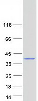 C1QTNF4 / CTRP4 Protein - Purified recombinant protein C1QTNF4 was analyzed by SDS-PAGE gel and Coomassie Blue Staining