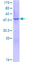 C1QTNF5 / CTRP5 Protein - 12.5% SDS-PAGE of human C1QTNF5 stained with Coomassie Blue