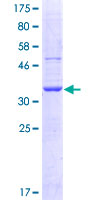C1QTNF5 / CTRP5 Protein - 12.5% SDS-PAGE Stained with Coomassie Blue.