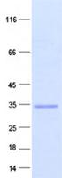 C1QTNF5 / CTRP5 Protein