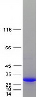 C1QTNF5 / CTRP5 Protein - Purified recombinant protein C1QTNF5 was analyzed by SDS-PAGE gel and Coomassie Blue Staining